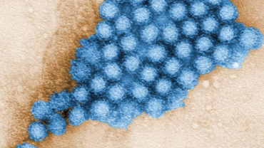 Norovirus Outbreak Linked to North County Restaurant Sickens Nearly 100 People